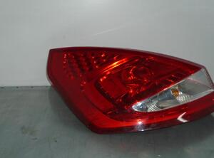 Schokdemper bumper FORD Fiesta VI (CB1, CCN)